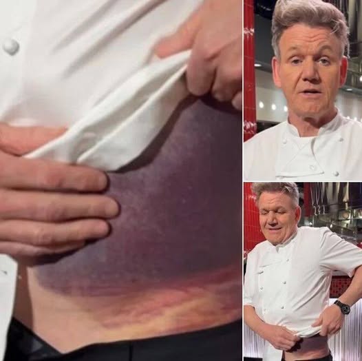 Gordon Ramsay shares important message after… - Weveryday Stories