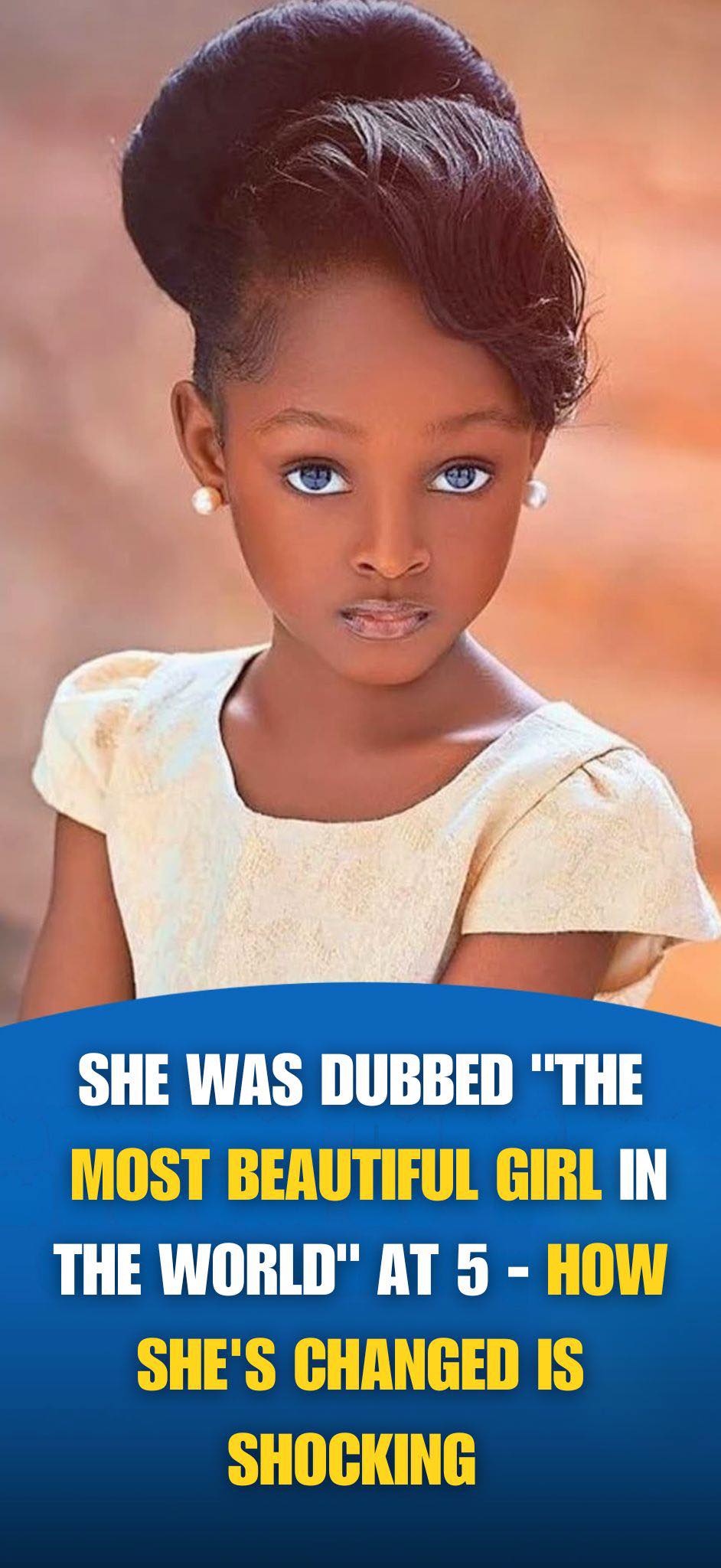 When She Was 5 She Had ‘The Most Beautiful Face In The World’ But Wait