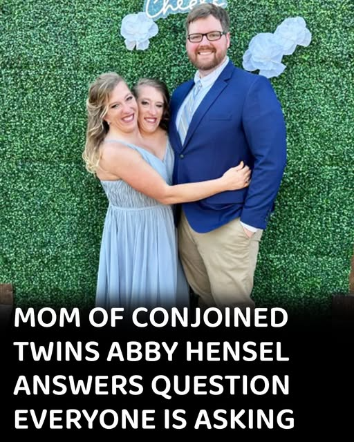 Mom of conjoined twins answers question everyone is asking Weveryday